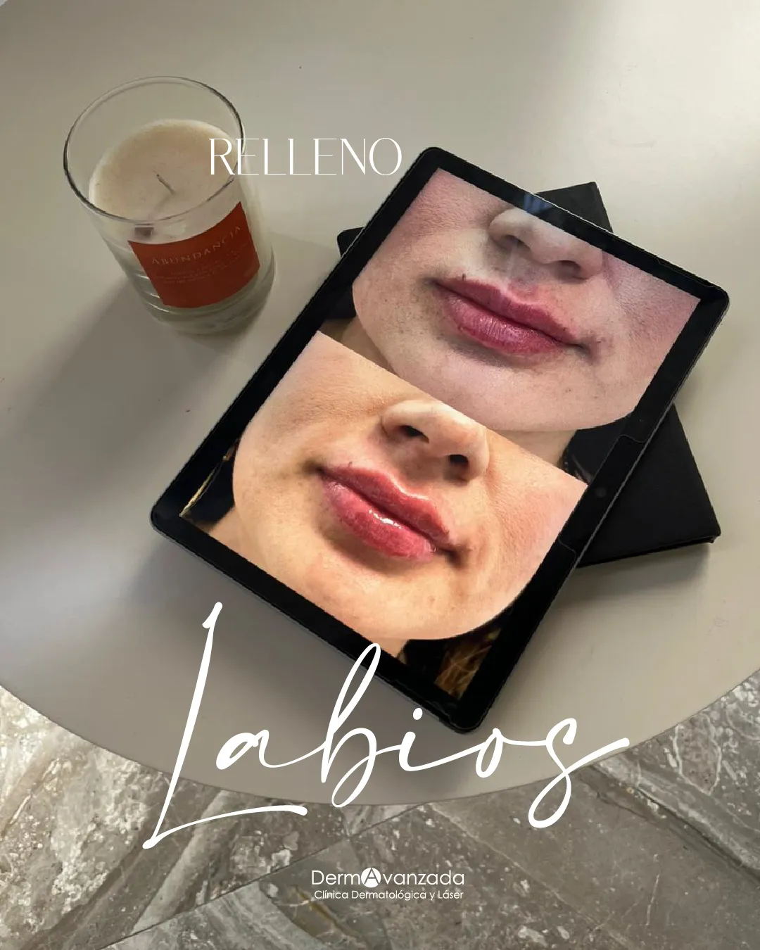 Post «Labios» con fotografía de una tablet que muestra labios